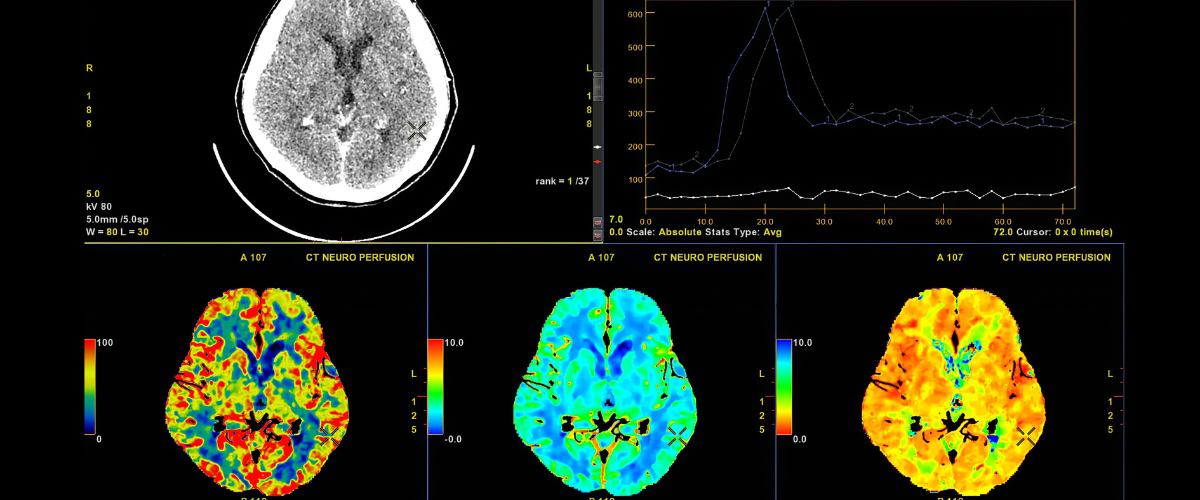 PET/CT OpenRad Knowledge base Diagnosis Tool